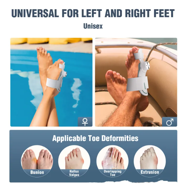 Adjustable Thumb Valgus Corrector Orthosis for Men and Women (3-Board, Varying Degrees)