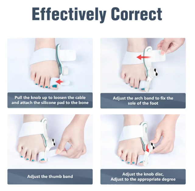 Adjustable Thumb Valgus Corrector Orthosis for Men and Women (3-Board, Varying Degrees)